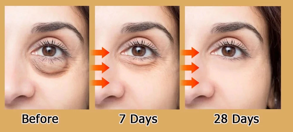 Eye Bags Cream Improve Eyes Wrinkle